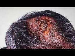 Şenol güneşin kafasına ne atıldı? Senol Gunes Kafasi Yarildi Son Dakika Youtube