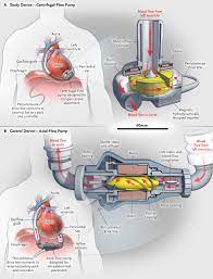 Lvad Spell Your Science