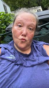 Advice for pre bariatric surgery preparation?