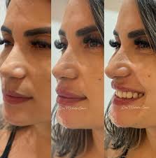 Instagram photo by Dra. Michelle Simas • Jul 13, 2025 at 4:54 PM