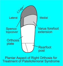 May 14, 2017 · welcome back to squat university! Kevin A Kirby Dpm Prescribing Better Custom Foot Orthoses Patellofemoral Pain Syndrome Patellofemoral Pain Syndrome Pfps Also Known As Anterior Knee Pain Patellofemoral Syndrome Runner S Knee And Chondromalacia Patella Is The
