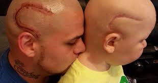 Immune defenders rush to tattoo's tiny wounds more than 30% of americans are tattooed today. Dad Tattoos His Son S Cancer Scar On His Own Head To Boost Son S Self Confidence Bored Panda