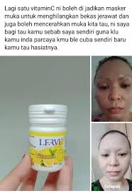 Wajah akan kelihatan cantik berseri 2. Vitamin C Home Facebook
