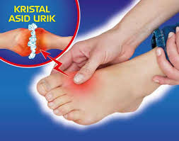 Check spelling or type a new query. Mencegah Sakit Gout Utusan Borneo Online