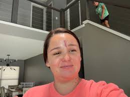 I was so ugly when I was born, the doctor slapped my mother!!