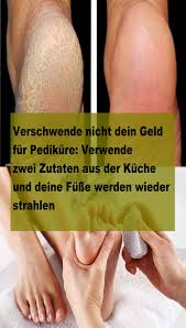 Verschwende Nicht Dein Geld Fur Pedikure Verwende Zwei Zutaten Aus Der Kuche Und Deine Fusse Feet Care Pedicure Skin Treatments