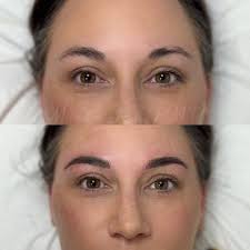 Microblading and shading to used to create some symmetry , definition and  filled in her bald spot! 😍😍