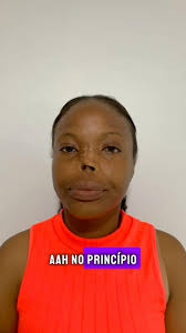 Nossa ida à Angola também teve reabilitacao por prótese bucomaxilofacial!  🙌🏼, Essa é a história da Cláudia, que vive em Luana e veio até Lubango  para receber a sua prótese nasal! Ela perdeu o nariz na ...