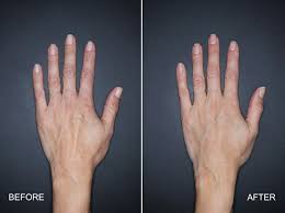 Hand modelling can be extremely lucrative with advertisers willing to pay a large sum of money. How Can I Be A Hand Model Model Factory