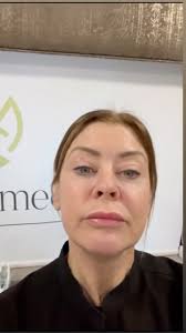 Boost your results after Morpheus8 with Demafocus Purasomes! Game changer!!  👀 This advanced treatment helps accelerate healing and enhance skin  regeneration, leaving you with smoother, tighter skin. ✨ ...