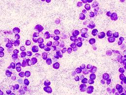 Image result for mastocytoma in dogs