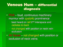 Image result for Venous Hum