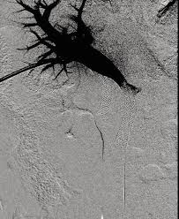 Peter has 15 jobs listed on their profile. Complete Resolution Of Acute Pancreatitis Induced Chylous Ascites Following Transhepatic Portal Vein Stenting Bmj Case Reports