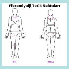 Hastalık, tetik noktaları olarak adlandırılan ağrılı keçelerin kas liflerinde ortaya çıkmaktadır. Fibromiyalji Belirtileri Tetik Noktalari Risk Faktorleri Ve Tedavisi Bilgiustam