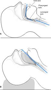 Learn vocabulary, terms and more with only rub 220.84/month. Airwayassessment Chapter 16 Essential Clinical Anesthesia