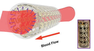 Your pulmonary vein brings blood back to your heart, and the process. Wisconsin Madison Scientists 3d Print Arteries To Enable Real Time Blood Pressure Monitoring 3d Printing Industry