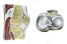 When ocd affects the knee, the most common location is within the lateral aspect of the medial femoral condyle. Medial Femoral Condyle Keyword Search Science Photo Library