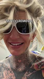 @Removery Laser Tattoo Removal #ad #removerytattoo #tattooremoval #tattoo  #carissadid