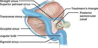 We studied the additional exposure provided by skeletonizing the sigmoid sinus (ss). The Sigmoid Sinus Sciencedirect