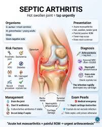 Image result for Septic Joint