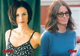Unfortunately, accidents, age or genes can lead to a loss of full or partial vision, leaving us with a foggy or blurred vie. Courteney Cox Plastic Surgery Did She Went Overboard Plastic Surgery Mistakes