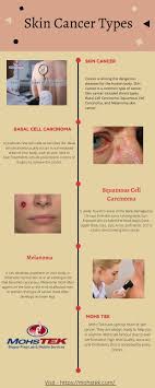 And it is important to recognize their signs and symptoms. Mohstek Com Skin Cancer Is A Common Type Of Cancer Skin Cancer Included Basal Cell Carcinoma Squamous Cell Carcinoma And Melanoma Skin Cancer 888 559 6647 Www Mohstek Com Skincancer Skin Cancer Surgery On Face Biopsy Prep Lab