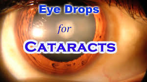 We will help you to start your eye drops. Lanosterol Eye Drops Cataract Could This Prevent Future Eye Damage