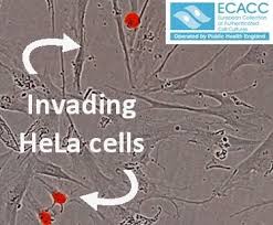 We did not find results for: Cell Line Cross Contamination And Misidentification Common Cell Culture Problems