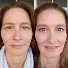 Fast movement trick in King's Choice