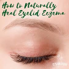 Eyelid dermatitis is a common condition that causes the skin on or around the eyelid to become dry, itchy, and irritated. How To Naturally Heal Eyelid Eczema It S An Itchy Little World