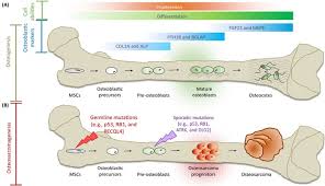 Osteosarcomas are primary malignant tumors of bone that are characterized by the production of osteoid osteosarcoma: Adc Development For Osteosarcoma Creative Biolabs