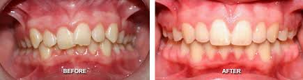 Smiles Gallery Children S Dental Village