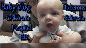 Research Study Helps Family of Patient with Tuberous Sclerosis Give Back