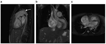 Image result for Dark Gray 1972 Caloric