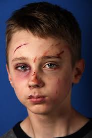 Fotos De Golpeado Imagenes De Golpeado Descargar Depositphotos
