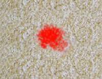 You can download 531*518 of blut aus couch entfernen now Blutflecken Entfernen Aus Kleidung Und Teppichen Philognosie