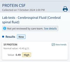 Image result for CSF Protein