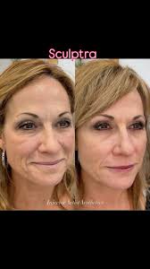 Instagram photo by Heather Marcel DeRoche, RN, Injector Artist Aesthetics •  Mar 18, 2025 at 7:56 AM