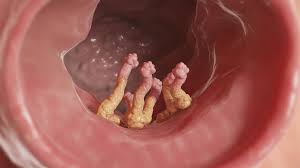 Image result for Centrostigma papillosum