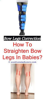 Permanent Remedy For Bow Legs What Causes Bow Legs In Teenagers How To Reduce Bow Legs Does Rickets Cause Bowed Bow Legged Correction Bow Legged Knock Knees