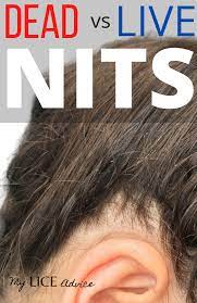 Dead Vs Live Nits Color Of Lice Eggs Lice Eggs Hair Nits Hair Growing Tips