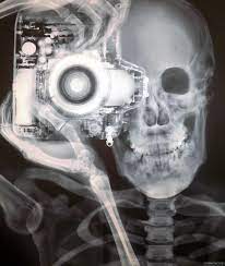We did not find results for: Pin By Amber Baker On Curiosa X Ray Images X Ray Photographer
