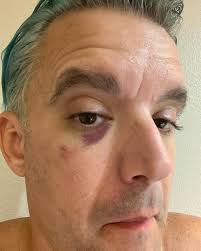 Frantastic Gaynor (@brand7) • Instagram photos and videos