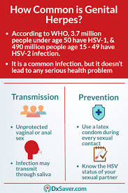 Pin On Std In United States