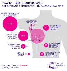 Breast Cancer Incidence Invasive Statistics Cancer