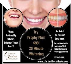 Check spelling or type a new query. Teeth Whitening Clarksville Tn Cosmetic Dentistry