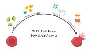 Image result for G6PD Deficiency