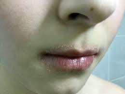 Dermatita atopica afecteaza intre 10 si 20% dintre copiii cu varsta de pana la 5 ani. Gseba Crema Pentru DermatitÄ AtopicÄ Si Seboreica La Copii Èi AdulÈi