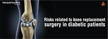 Jul 27, 2017 · no set distance understand that there is no set distance for a patient to walk or not to walk, once he has made a full recovery from knee replacement surgery 1 2. Risks Related To Knee Replacement Surgery In Diabetic Patients