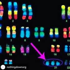 Ln occasione della giornata mondiale della sindrome di down, inoltre, coordown onlus (coordinamento nazionale associazioni delle persone con sindrome di down) ha lanciato la campagna di sensibilizzazione internazionale reasons to celebrate, per denunciare quanto ancora siano. Giornata Internazionale Delle Persone Con Sindrome Di Down Iniziativa Calzini Spaiati E Vendita Di Cioccolata Solidale Agpd Scuola Dell Infanzia Giovanni Xxiii